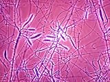 Avian Flu Photomicrograph Microsporum Gallinae Fowl Photographic Poster Print, 24x18