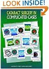 Cataract Surgery in Complicated Cases