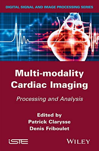 Multi-modality Cardiac Imaging: Processing and Analysis (ISTE)