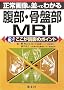 ����摜�ƕ��ׂĂ킩�镠���E���Օ�MRI�\�������ǉe�̃|�C���g