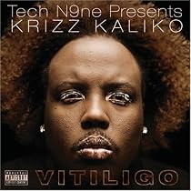 Vitiligo