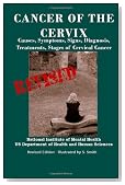 Cancer Of The Cervix: Causes, Symptoms, Signs, Diagnosis, Treatments, Stages of Cervical Cancer- Revised Edition - Illustrated by S. Smith