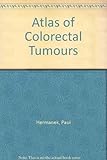 Atlas of colorectal tumors