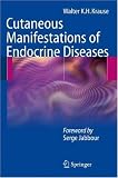 Cutaneous Manifestations of Endocrine Diseases
