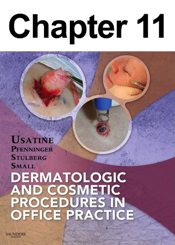 The Elliptical Excision: Chapter 11 of Dermatologic and Cosmetic Procedures in Office Practice