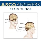 Brain Cancer Fact Sheet (pack of 125 fact sheets)