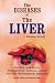 Books : The Diseases of Liver: Jaundice, Gall-stones, Enlargement, Tumours Cancer and Their Homoeopathic Treatment