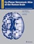 Co-Planar Stereotaxic Atlas of the Human Brain: 3-D Proportional System: An Approach to Cerebral Imaging (Thieme Classics)
