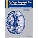 Co-Planar Stereotaxic Atlas of the Human Brain: 3-D Proportional System: An Approach to Cerebral Imaging (Thieme Classics)
