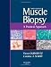 Muscle Biopsy: A practical approach