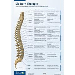 Die Dorn-Therapie. Poster 59,4 x 84 cm: Beziehung zwischen Wirbeln und organischen sowie psychischen Beschwerden