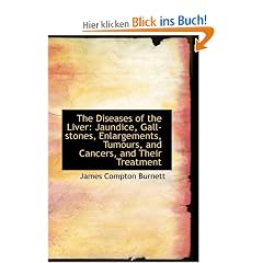 The Diseases of the Liver: Jaundice, Gall-Stones, Enlargements, Tumours, and Cancers, and Their Trea