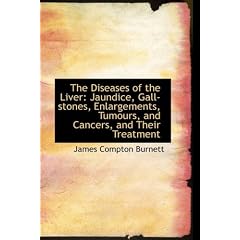 The Diseases of the Liver: Jaundice, Gall-Stones, Enlargements, Tumours, and Cancers, and Their Trea