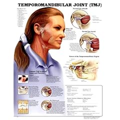 Temporomandibular Joint (TMJ) Anatomical Chart by Anatomical Chart Company