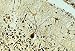Book Genes and Disease - Skin and Connective Tissue