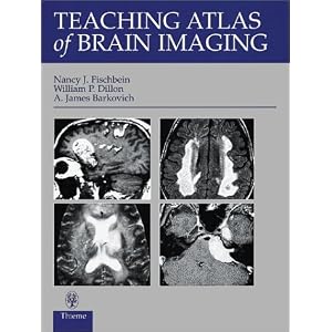 Click here to buy Teaching Atlas of Brain Imaging (Teaching Atlas Series) by Nancy Fischbein, William Dillon, and A. James Barkovich.
