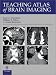 Books : Teaching Atlas of Brain Imaging (Teaching Atlas)
