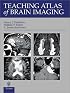 Teaching Atlas of Brain Imaging (Teaching Atlas)