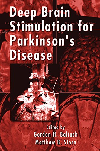 Deep Brain Stimulation for Parkinson's Disease (Neurological Disease and Therapy)