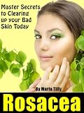 Rosacea "Master Secrets to Clearing up your Bad Skin Today!"