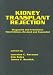 Book Kidney Transplant Rejection: Diagnosis & Treatment