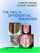Book Nail in Differential Diagnosis