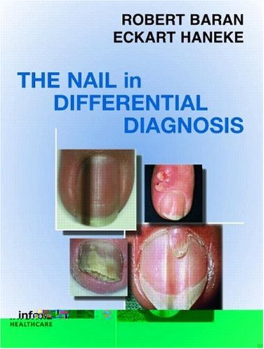 Nail in Differential Diagnosis
