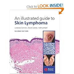 An Illustrated Guide to Skin Lymphoma