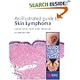 An Illustrated Guide to Skin Lymphoma