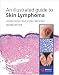 An Illustrated Guide to Skin Lymphoma by Lorenzo Cerroni ISBN 1405113766