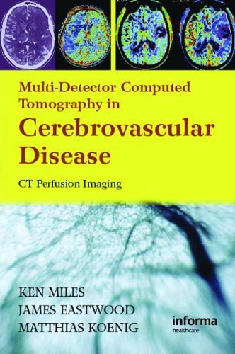 Computed-Tomography