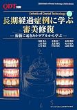 長期経過症例に学ぶ審美修復―術後に起きたトラブルから学ぶ