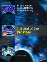 Imaging of the Prostate