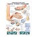 Carpal Tunnel Syndrome Chart