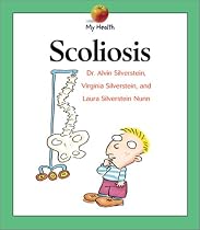 My Health: Scoliosis