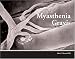 Myasthenia Gravis: An Illustrated History