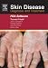 Books : Skin Disease CD-ROM PDA Software: Diagnosis and Treatment