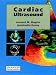 Books : Cardiac Ultrasound