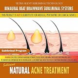 Natural Acne Treatment