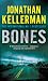 Bones