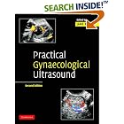 Practical Gynaecological Ultrasound by  Jane Bates