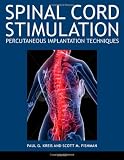Spinal Cord Stimulation Implantation: Percutaneous Implantation Techniques