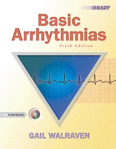 image of Basic Arrhythmias (6th Edition)