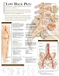 Understanding Low Back Pain Laminated Chart