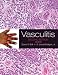 Book Vasculitis