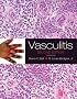 Vasculitis
