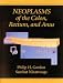 Book Neoplasms of the Colon, Rectum, and Anus
