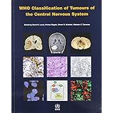 who classification of tumours of the central nervous system iarc who classification of tumours v 1