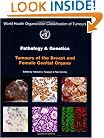World Health Organization: Tumours of the Breast and Female Genital Organs (Who/IARC Classification of Tumours) (IARC WHO Classification of Tumours)