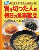 カード式 胃を切った人の毎日の食事献立